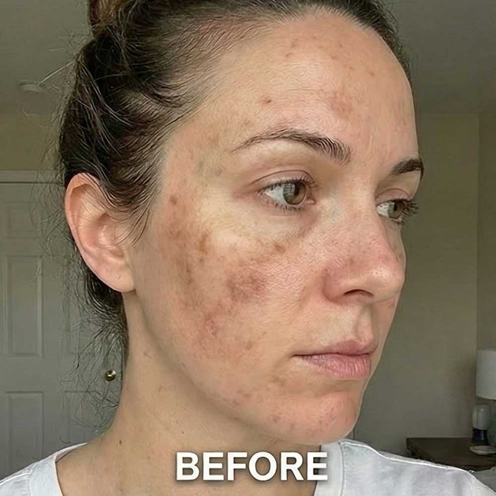 Before Serum